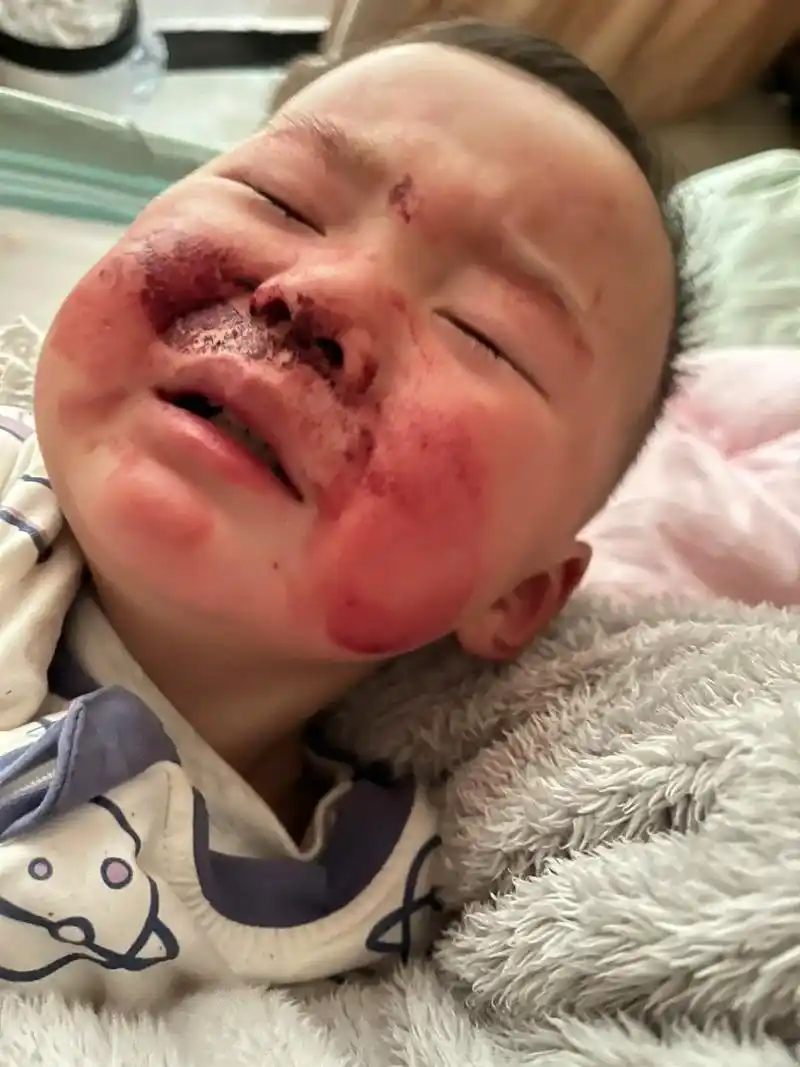 一个月前因为流了两次鼻血,去医院给他检查了啥事没有,医生说是 - 抖