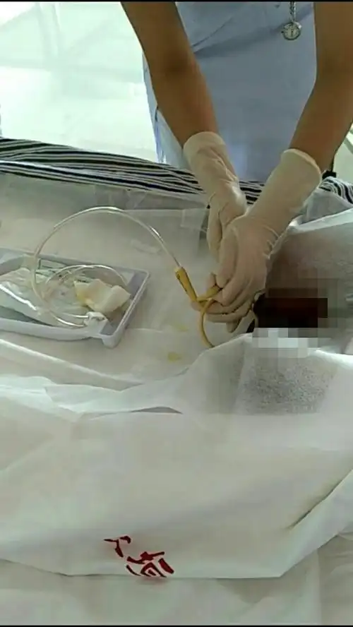 【襄垣县人民医院】中医科,外科全体护理人员进行了男患者留置导尿术