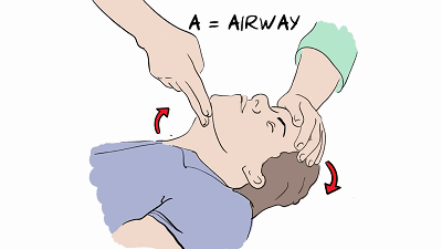 胸廓起伏,没有胸廓起伏则提示呼吸停止.