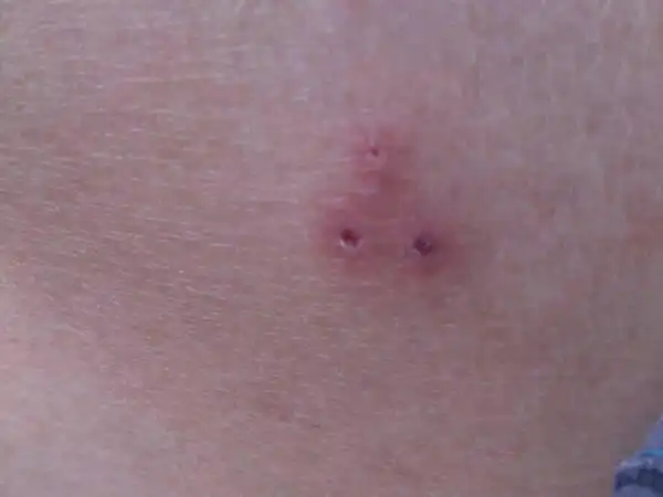 26 被老鼠咬了应该立即消毒即:用清水洗净伤口后立即用酒精消毒.