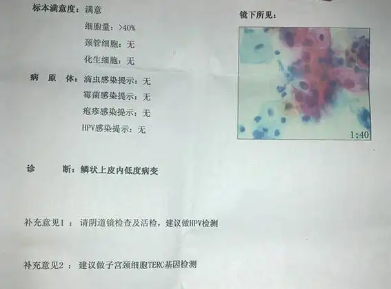它是目前国际上较先进的一种宫颈癌细胞学检查技术,与传统的宫颈刮片