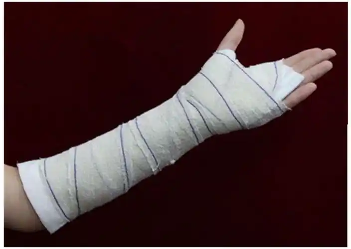 新型高分子石膏夹板绷带手臂腿部急救塑形固定护具 高分子夹板7.