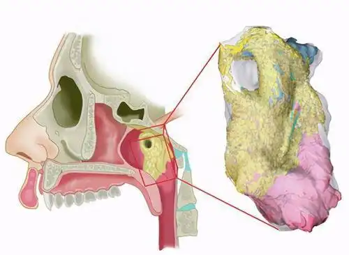 发现人类新器官管状唾液腺tubarialglands