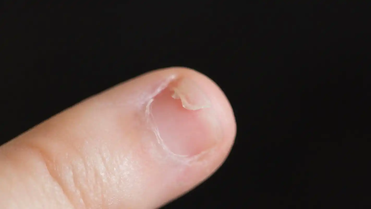 孩子指甲凹凸不平是缺钙吗?不一定,也有可能是缺乏维生素,微量元素.