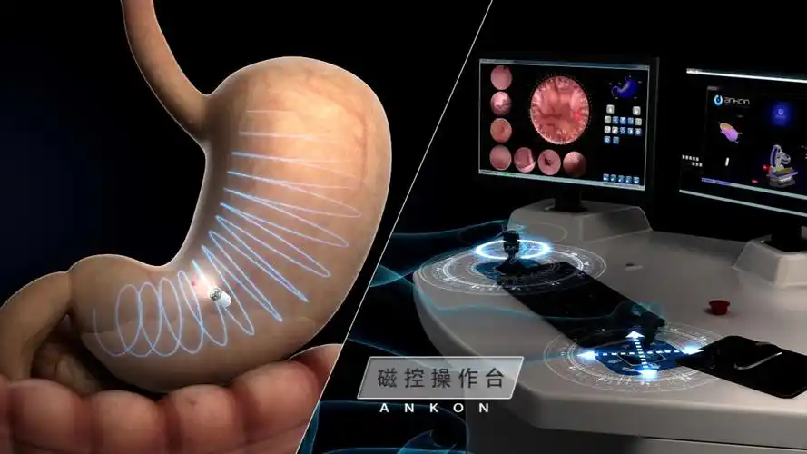 黑科技!安翰磁控胶囊胃镜