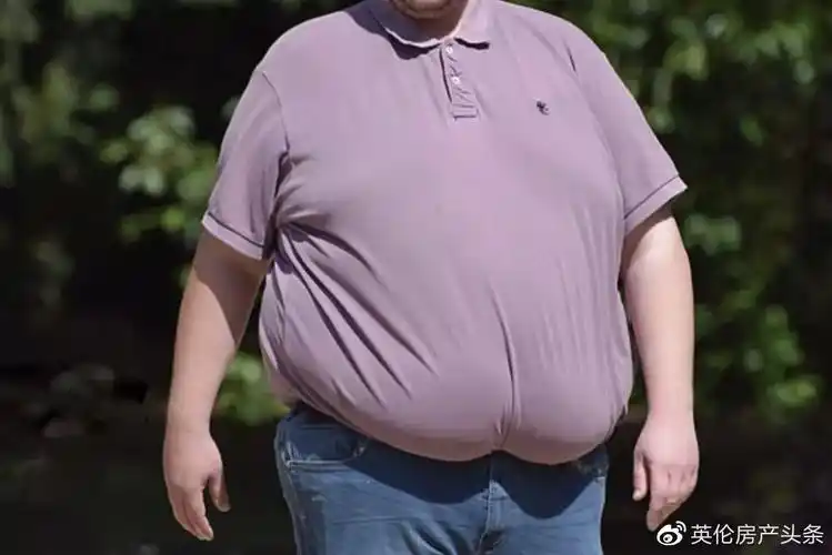 肥胖症患者/ 天空新闻网