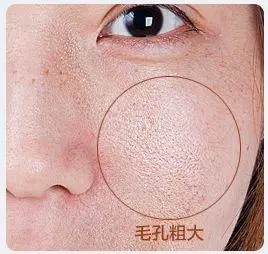 增加毛孔的张力,细腻毛孔,扯平凹陷细纹,预防和改善干纹细纹,色斑