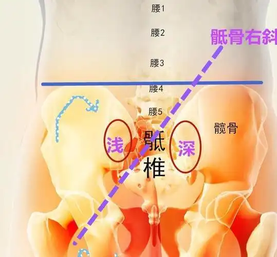 肌肉|医生|症状|骶骨|下背痛|人工膝关节_网易订阅