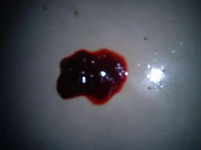 其实,如果大便有血的话,无论是什么颜色,鲜红,甚至浓黑,都应该引起