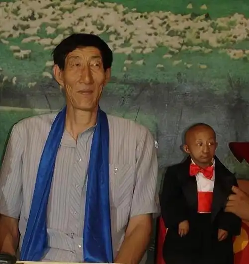 回顾身高236米的鲍喜顺不听医生忠告执意生子如今儿子多高