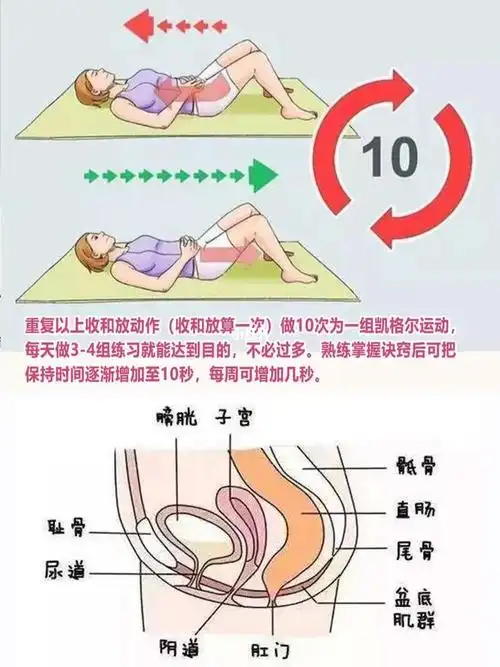 谈凯格尔运动必定要说盆底肌的_盆底肌_凯格尔运动_生活质量_泵秘