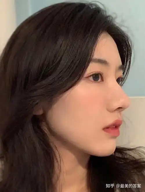 发挥较稳,自然风格,审美很好做直鼻和直鼻微翘多,对鼻翼缘的矫正,漏