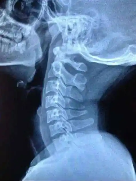 拿什么拯救孩子的颈椎?