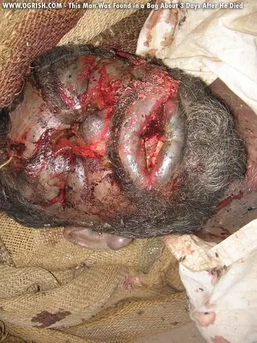 [金牌无聊贴]尸体腐烂过程配图详解(慎入) - 搜狐社区