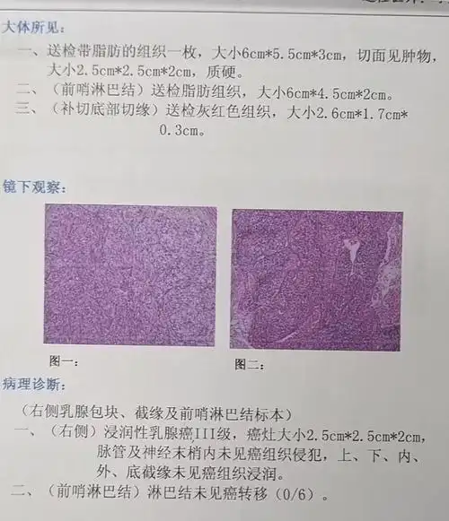 肿瘤疾病病理形态学编码常见问题答疑(三)_诊断_细胞_表皮