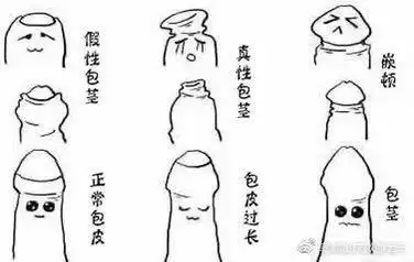 长是指包皮覆盖尿道口,但能上翻,露出尿道口和阴茎头,但往往伴有包茎