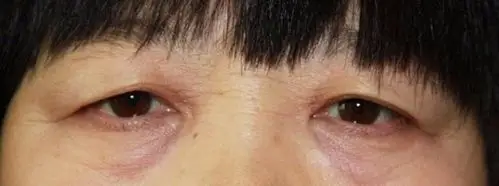 我想请问 我是三角眼嘛 不是的话 是什么眼 谢谢了