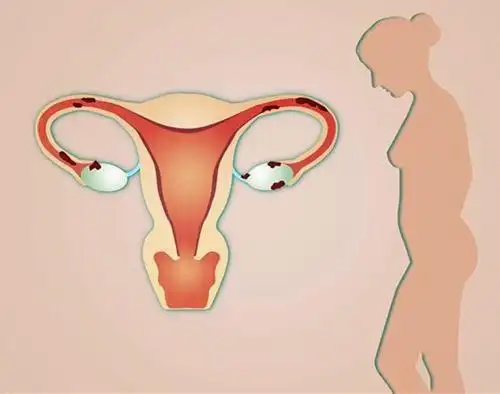 后果比男人还可怕,子宫好不好看这部位就知道_网易订阅