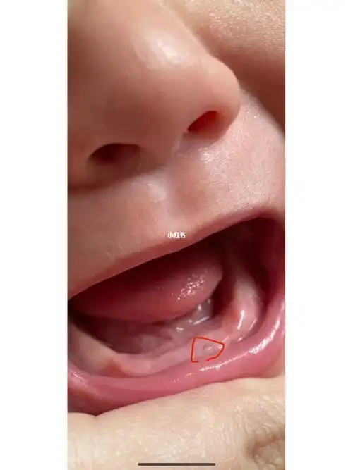 78号虎宝宝五个月啦终于长牙了