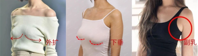 而且长期不穿内衣的话,胸部没有支撑,在地心引力的作用下,很快就会