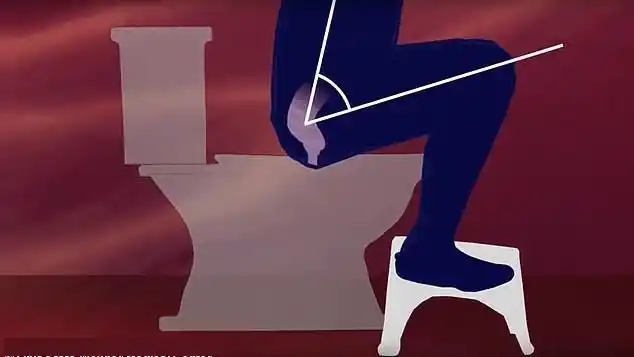 排便时是蹲着好还是坐着好?