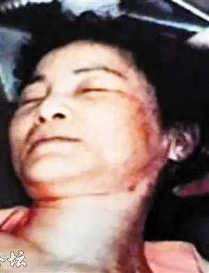 邓丽君绝密尸检照曝光疑被法国小男友气死图