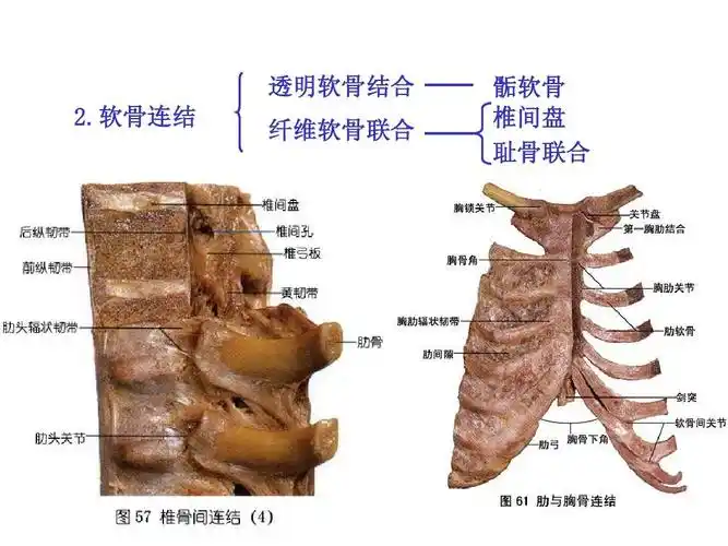 软骨连结 纤维软骨联合 骺软骨 椎间盘 耻骨联合 4 第4页 (共91页