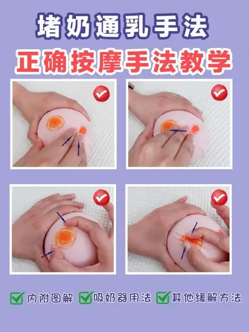 堵奶通乳手法常见自救方法在家轻松追奶