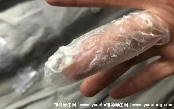 为什么氟康唑一天吃三粒停三天再吃