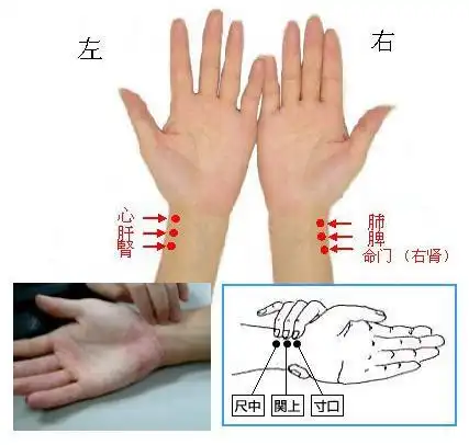 简单学号脉;中医号脉有诀窍 - m18513509086 - 传承中医,诊脉,脉诊