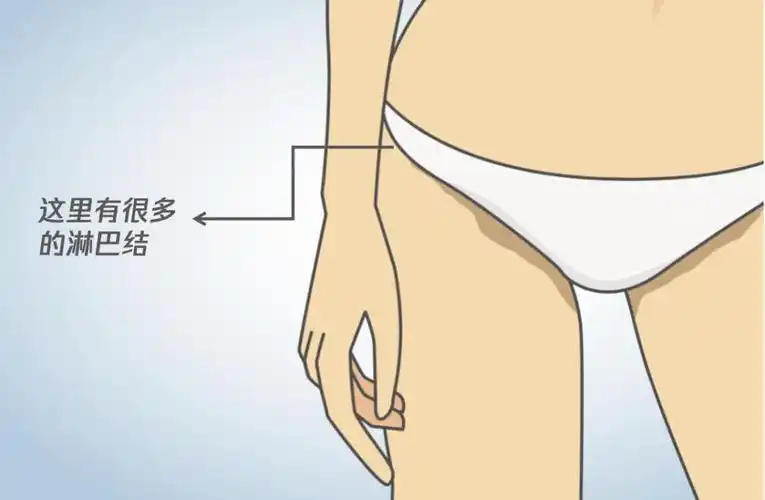 女生这个部位长了小疙瘩可能不是妇科病而是淋巴结肿大