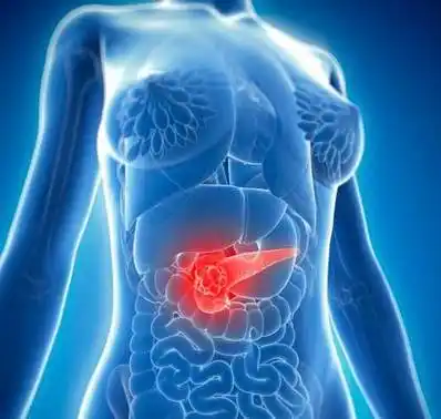 吉西他滨是dna复制的高效抑制剂,是胰腺导管腺癌(pdac)在内的多种癌症