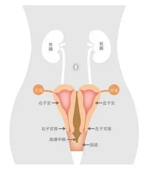 当"双子宫"遇上子宫腺肌症,怎么办?一定要切除吗?能否保宫?