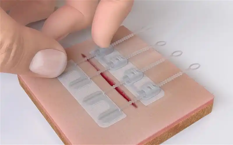 国外发明拉链式创可贴,受伤时只需轻轻一拉,伤口不会留下疤痕!