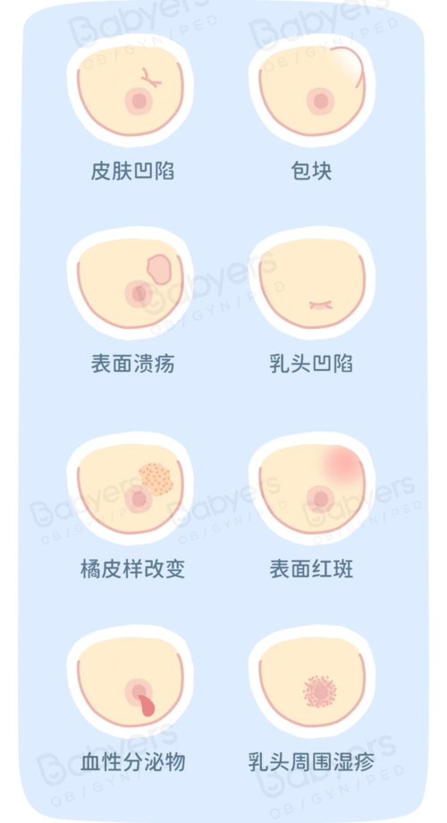 杭州美华提醒:一张图教你「乳房自检」,乳腺问题早发现