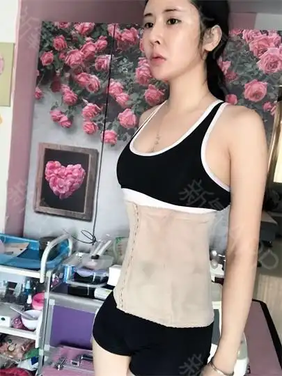 吸脂瘦腰腹好不好_效果图_我就是喜欢表演吸脂瘦腰腹术后第7天_新氧