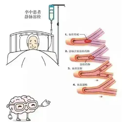 【技术分享】安溪中医院:三分钟卒中溶栓再创"新记录"_患者_治疗_时间