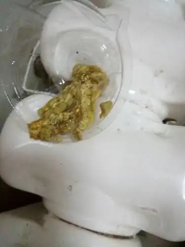 宝宝肺炎住院五天了,拉这样的便便,正常嘛?