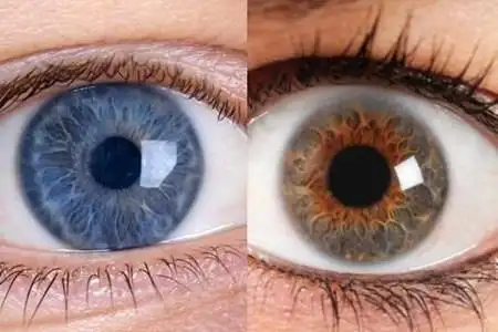 图告诉你瞳孔放大的原因了解这些从眼睛辨别真假