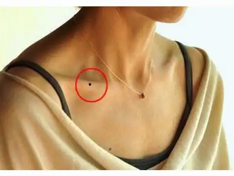 锁骨长痣代表什么 锁骨有痣好不好