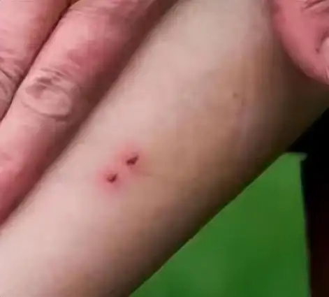 乌龟|兔子|银环蛇|小动物_网易订阅