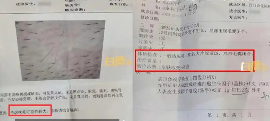 宝宝满月被剃胎毛导致毛囊闭合?真相是…_头发_剃头_生理