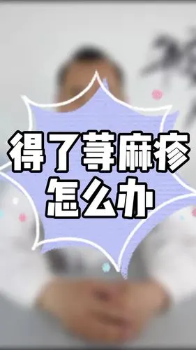 得了荨麻疹怎么办?_荨麻疹_医疗健康_医疗健康其他