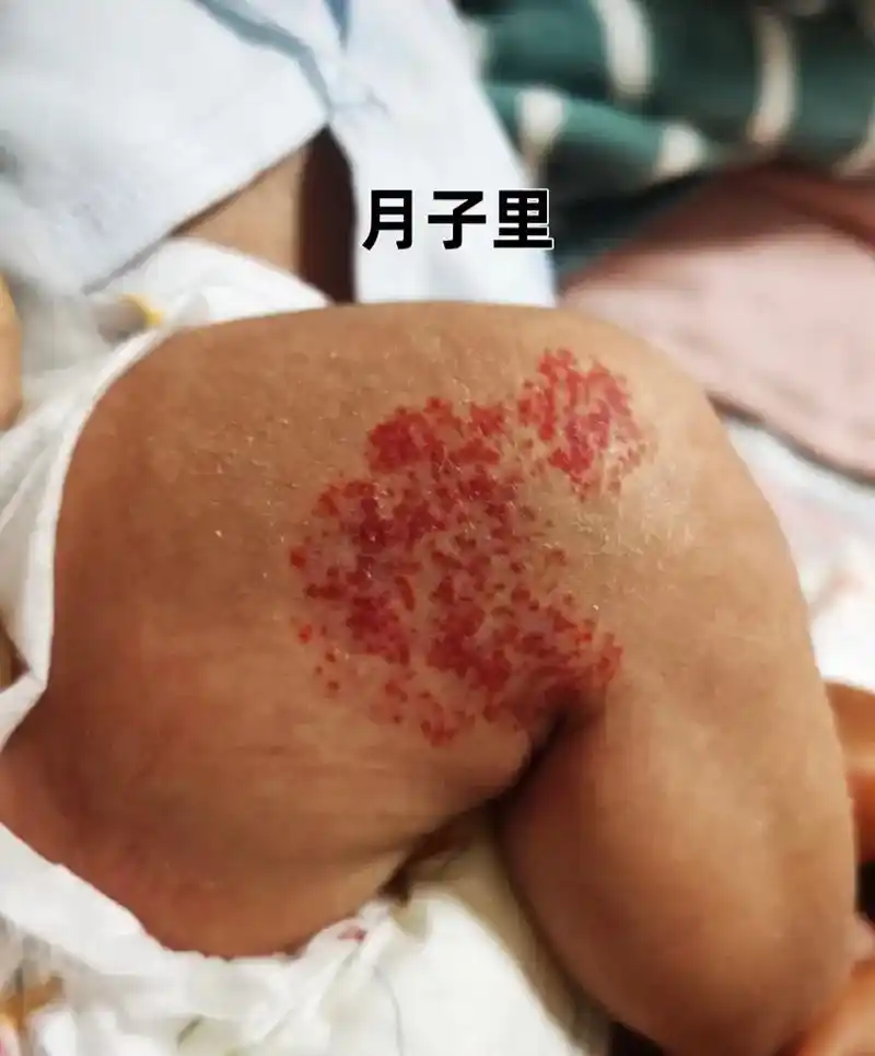 有知道懂这个的朋友吗?#血管瘤 我宝宝出生的时候腿上没有长这 - 抖音