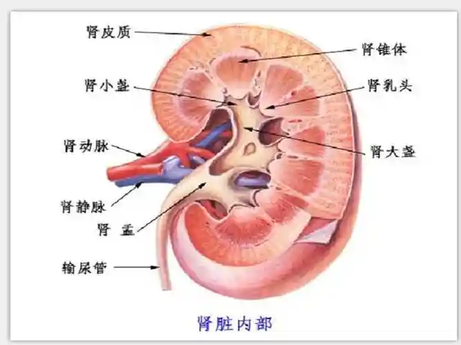急性肾盂肾炎课件