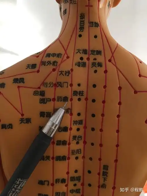 巧用拔罐调理肾炎