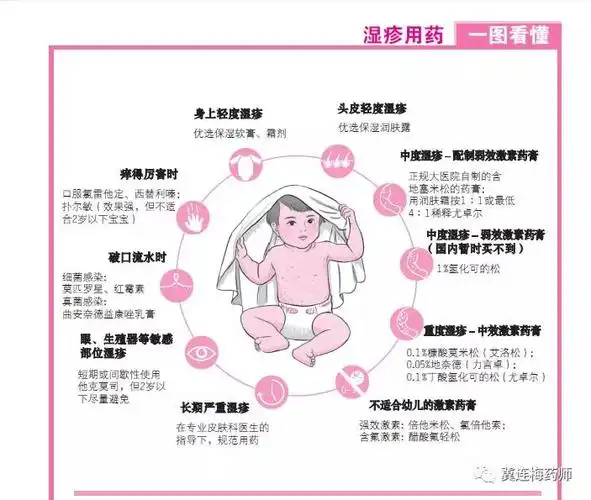 儿童「汗疱疹」,怎么治?