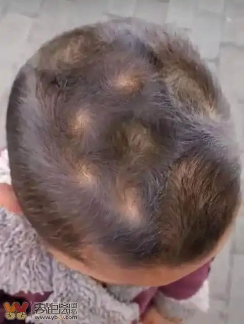 当了十几年的理发师,第一次遇到头上五个旋的