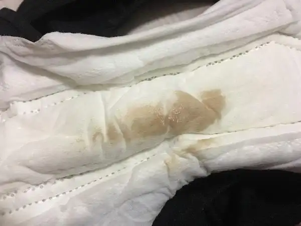 白带是这颜色怎么回事呢