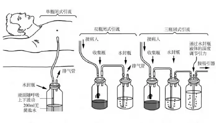 图1-32 胸腔引流管与水封瓶连接管连接【注意事项】1.